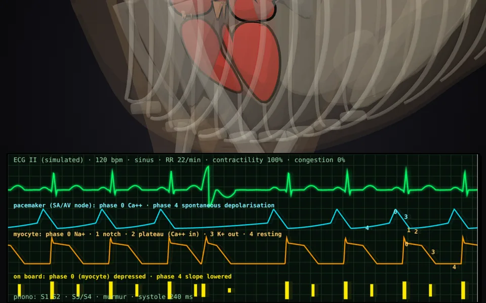 A dog's ECG and action-potential curves settling into a regular rhythm after IV lidocaine.